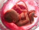 Преждевременная отслойка плаценты на поздних сроках беременности: когда промедление опасно для жизни малыша?
